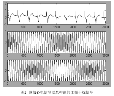 原始心電信號(hào)以及所構(gòu)造的工頻干擾信號(hào)