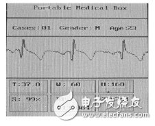  基于STM32的便攜體檢裝置的設計與實現