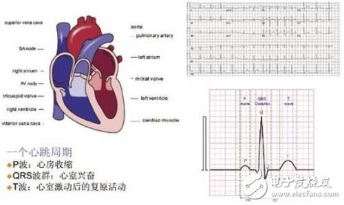 利用ECG AFE簡化病人監護儀設計