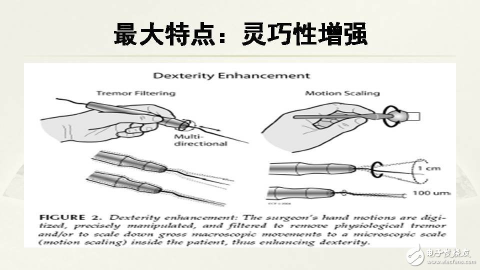 一文看懂手術(shù)機(jī)器人的現(xiàn)狀和未來(lái)前景